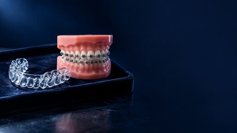 تقويم أسنان شفاف ومجسم أسنان بتقويم معدني على صينية مخملية داكنة